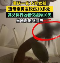 重庆15岁女孩被母亲男友砍伤十多处 家属质疑砍伤女儿男子仅行拘10日