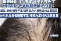 16岁男孩每天只睡5小时头秃了 爷爷爸爸都没秃16岁男孩先秃了